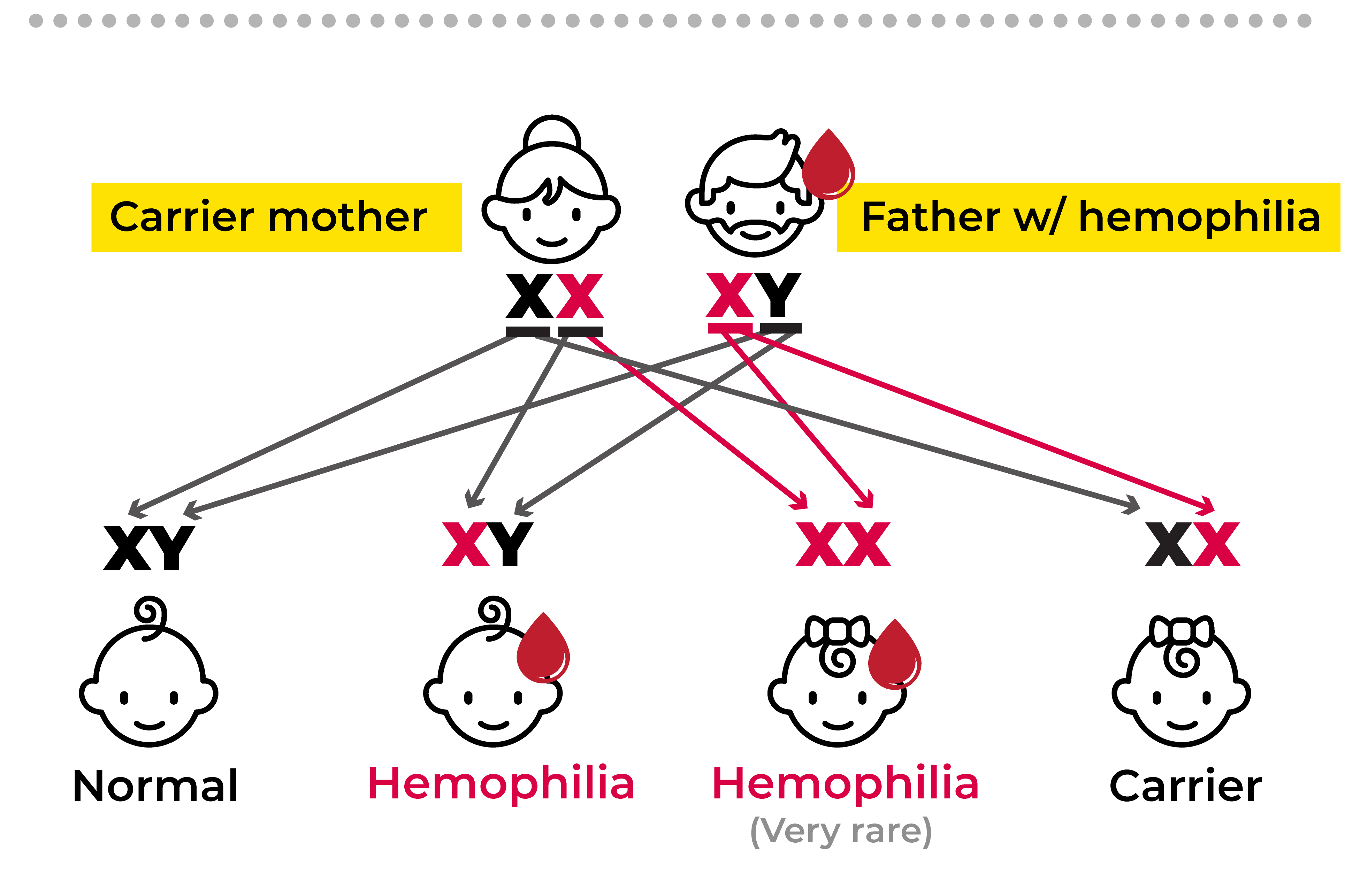 Hemophilia with a carrier mother and a affected father