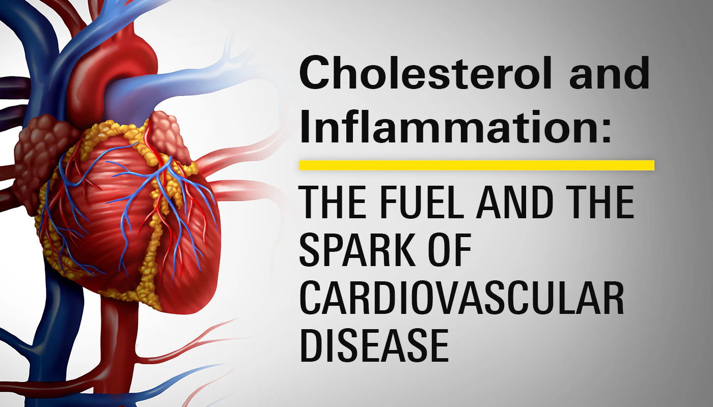 Cholesterol and Inflammation The Fuel and the Spark of Cardiovascular