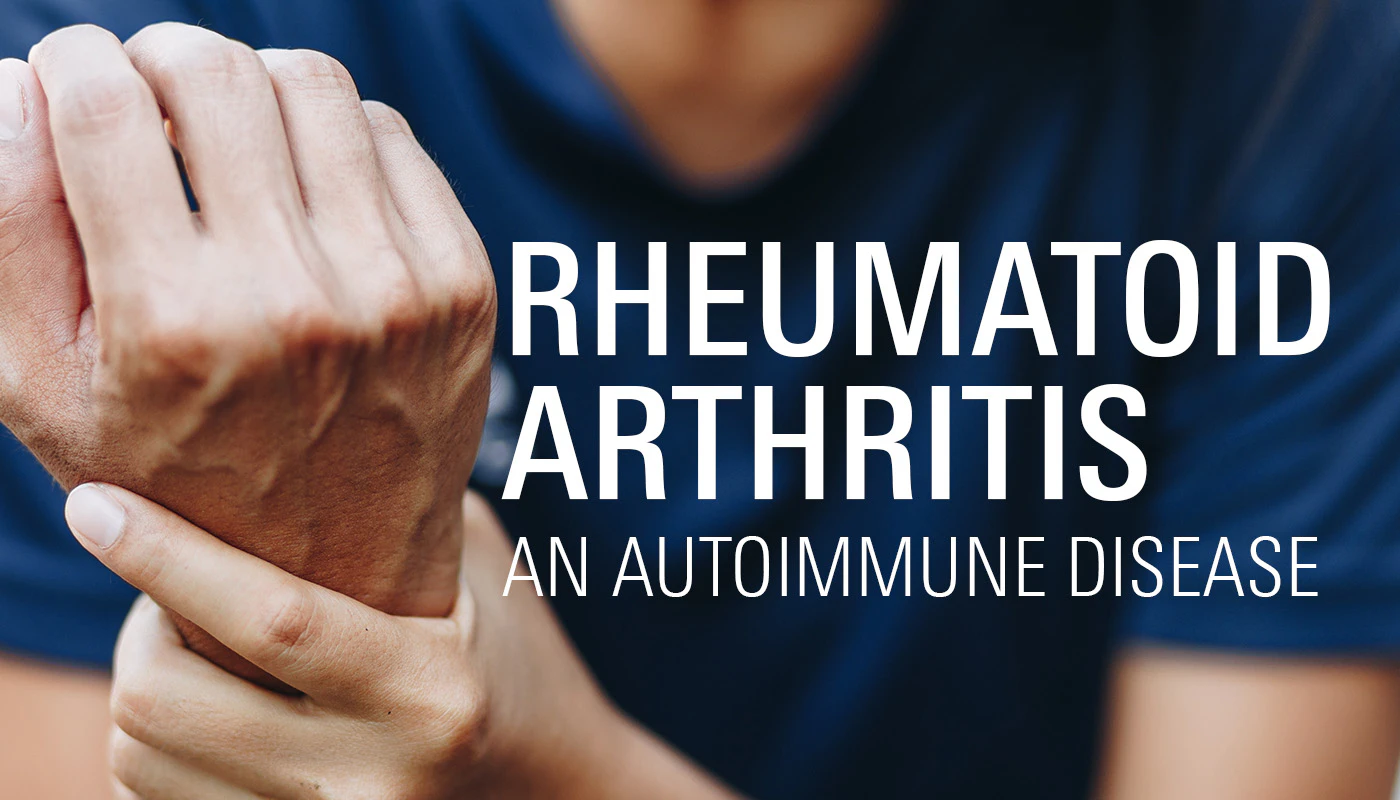 Rheumatoid Arthritis