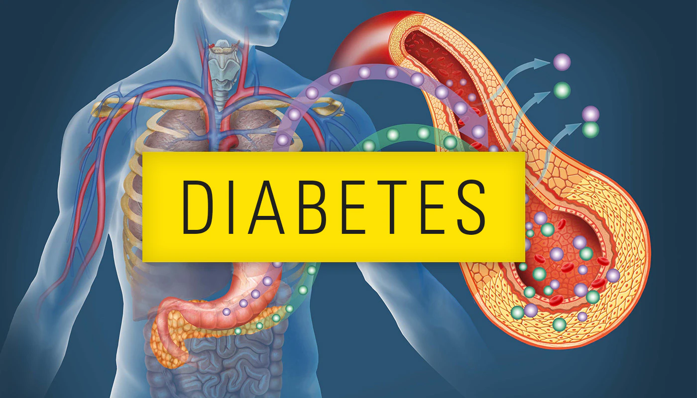 Understanding Diabetes - Symptoms, Testing, Risk Factors and More