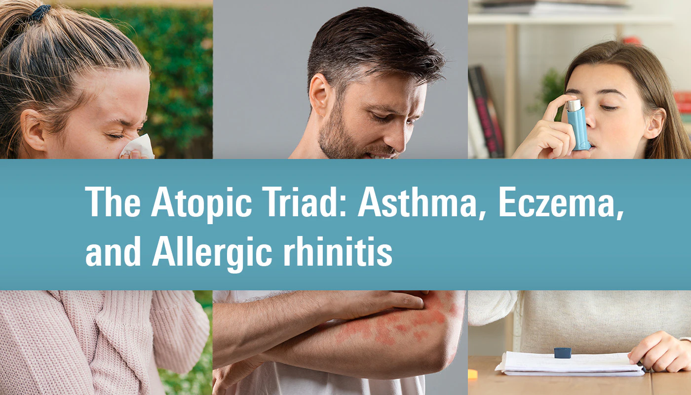 The Atopic Triad: Asthma, Eczema, and Allergic Rhinitis