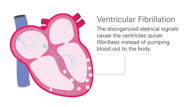 What Is A Ventricular Heart Anatomy Of The Heart Pdf GCZNU What Is A Ventricular Heart Anatomy Of The Heart Pdf GCZNU