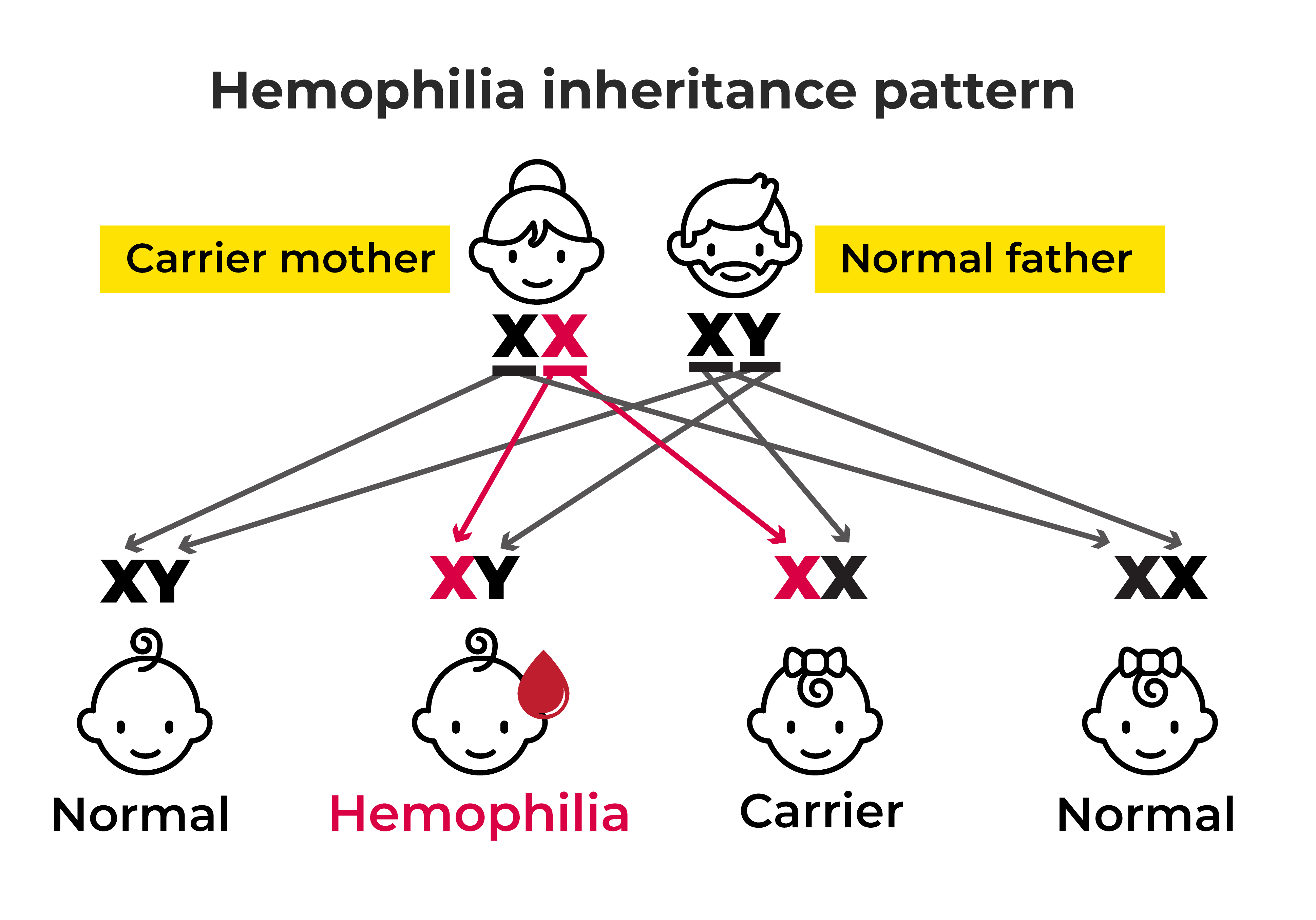 Hemophilia with a carrier mother and an unaffected father