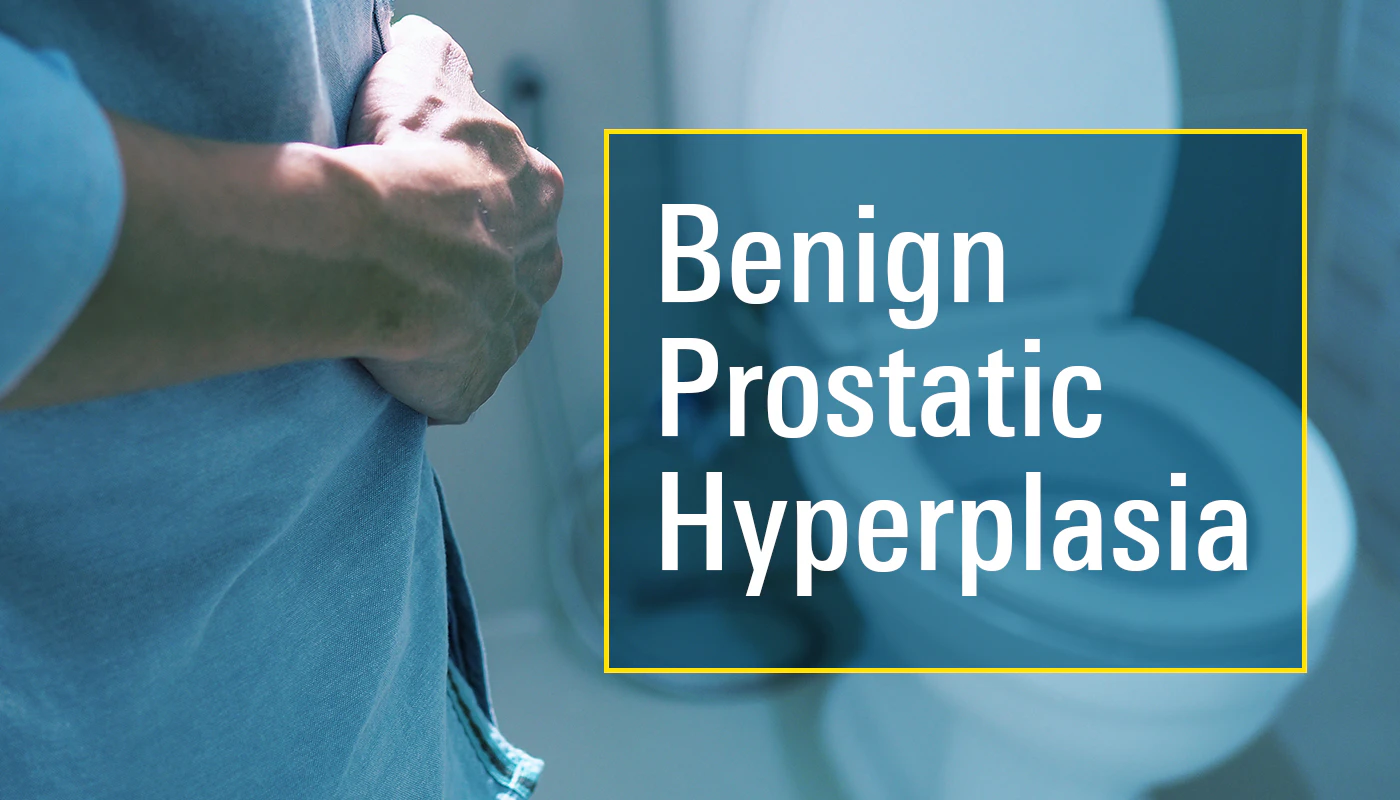 What Causes An Enlarged Prostate Bph Explained 52 Off What Causes An Enlarged Prostate Bph Explained 52 Off
