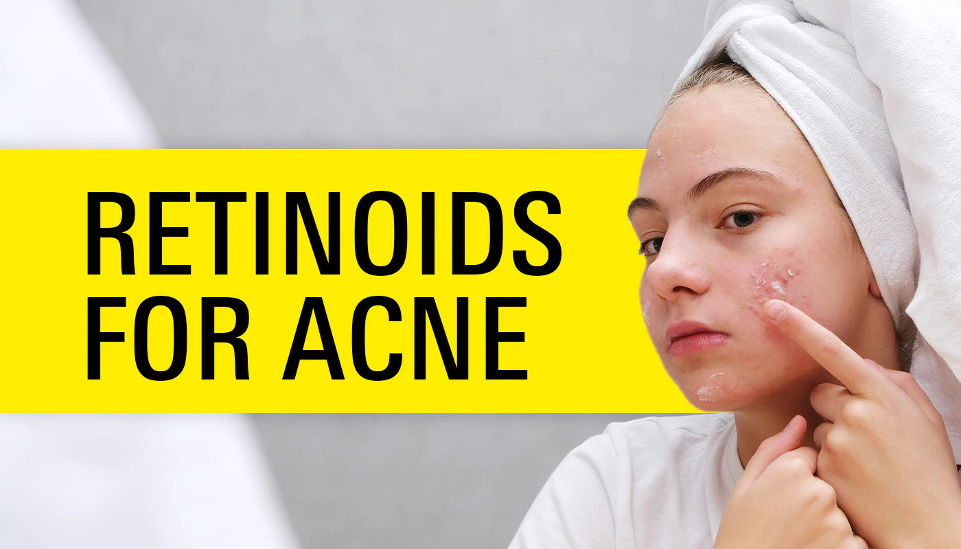 Retinoids for Acne