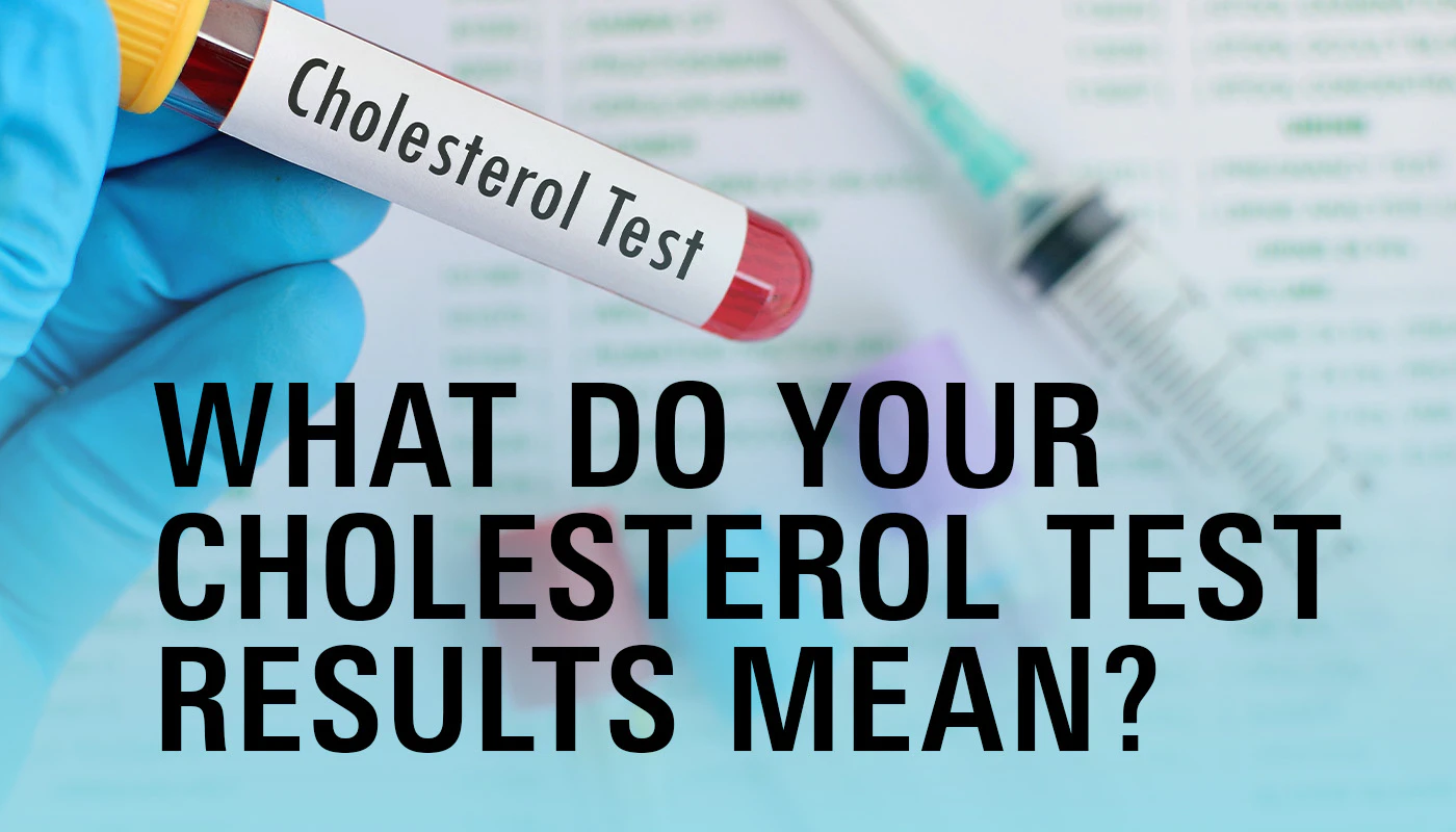 What Do Your Cholesterol Test Results Mean?