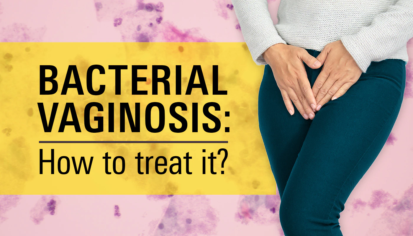 What Is Bacterial Vaginosis And How Is It Treated 4017