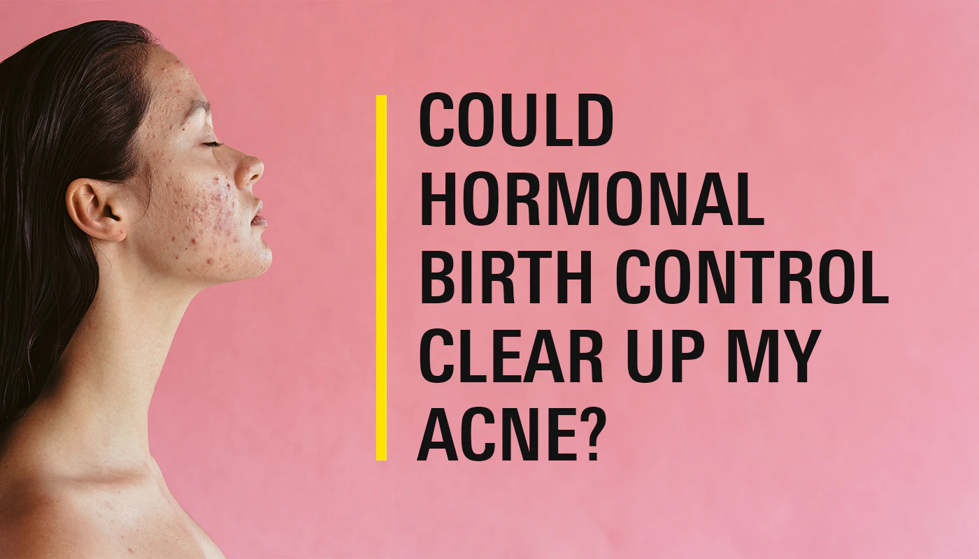 Hormonal Birth Control for Acne